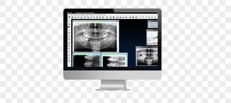 png clipart computer software medical imaging radiology rie kavo dental gmbh x ray machine
