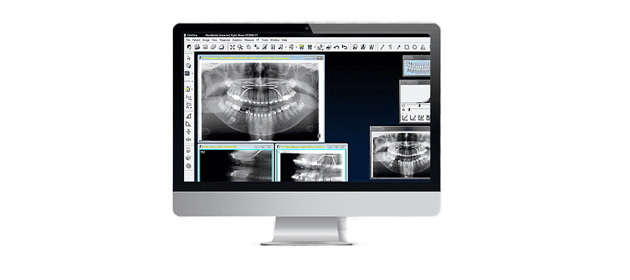 png clipart computer software medical imaging radiology rie kavo dental gmbh x ray machine