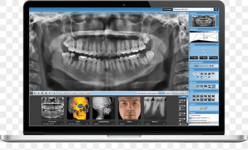 png clipart dentistry medicine medical imaging dental radiography computer monitors others