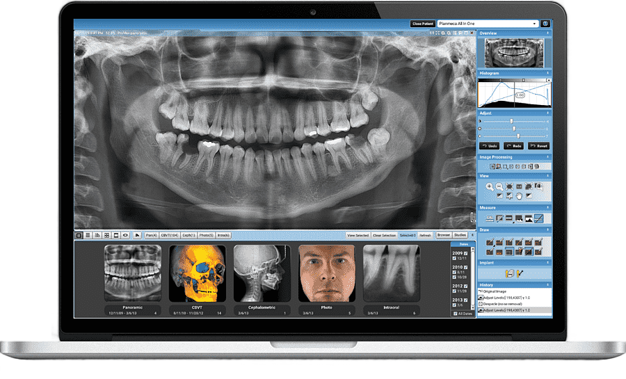 png clipart dentistry medicine medical imaging dental radiography computer monitors others