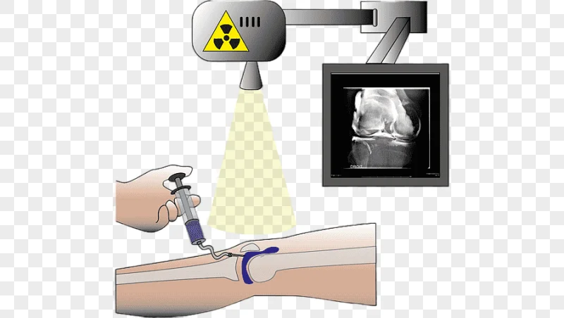 png clipart injection radiology arthrogram computed tomography magnetic resonance imaging
