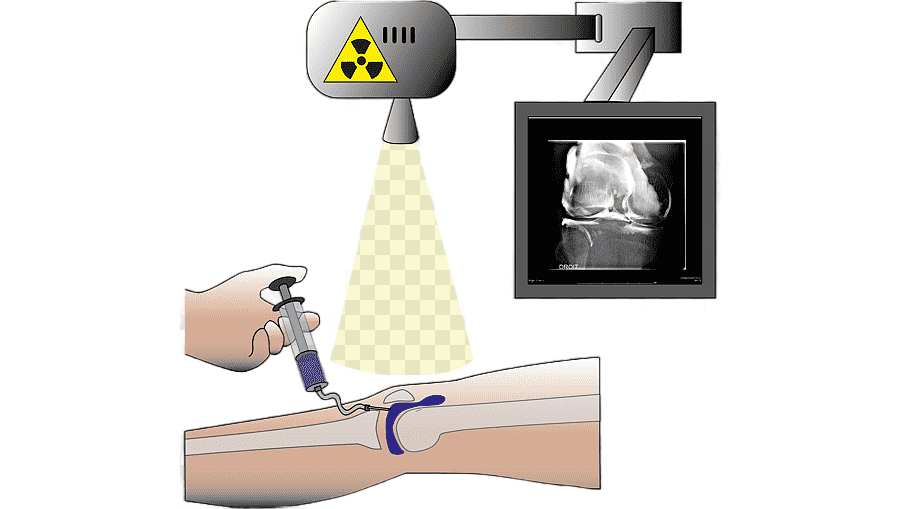 png clipart injection radiology arthrogram computed tomography magnetic resonance imaging