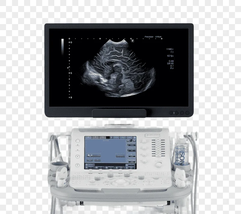 png clipart medical equipment ultrasonography medicine medical imaging medical diagnosis t
