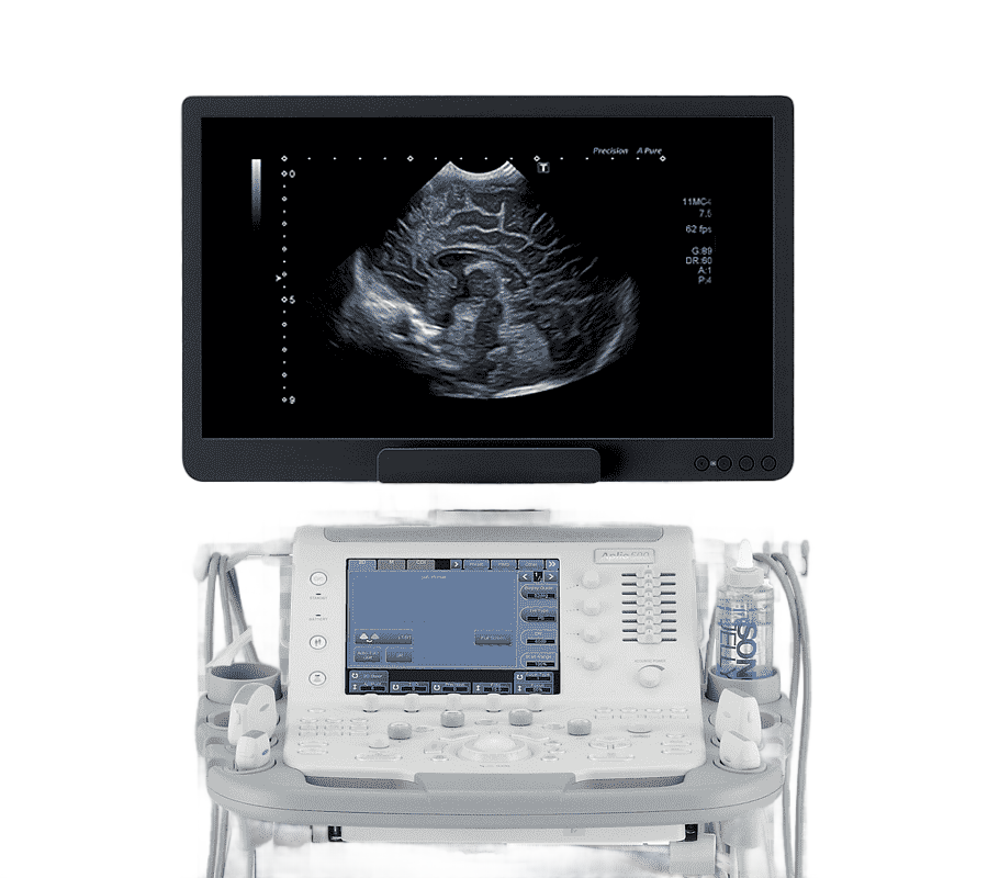 png clipart medical equipment ultrasonography medicine medical imaging medical diagnosis t