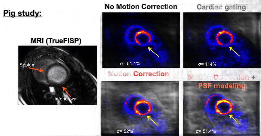 png clipart medical imaging positron emission tomography magnetic resonance imaging pet ct