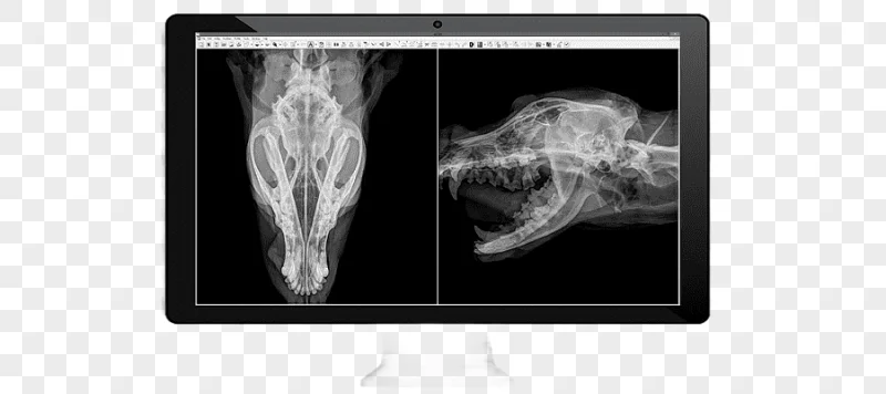 png clipart medical imaging radiology medicine x ray radiography others digital computer w