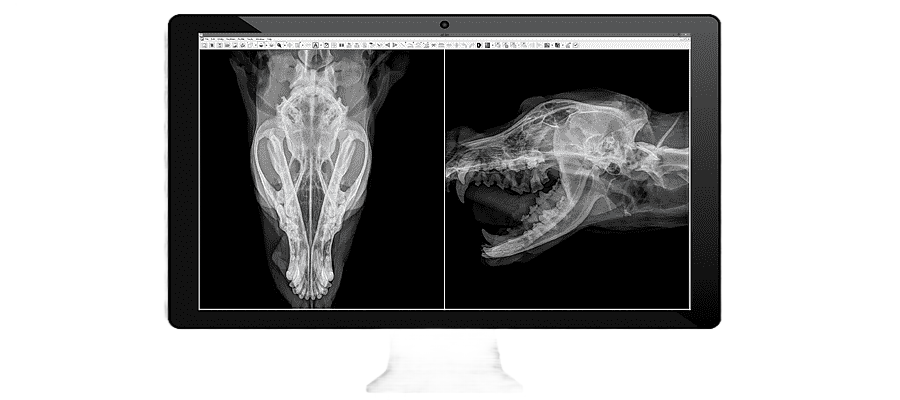 png clipart medical imaging radiology medicine x ray radiography others digital computer w