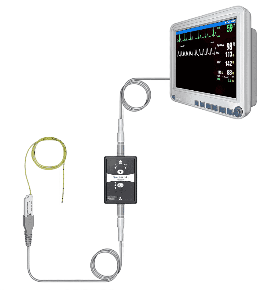 png clipart neurology intracranial pressure magnetic resonance imaging neurointensive care