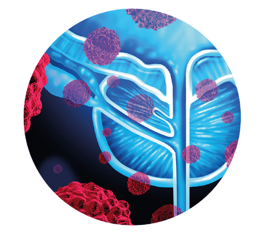 png clipart prostate cancer prostate specific antigen metastasis medical imaging von wille