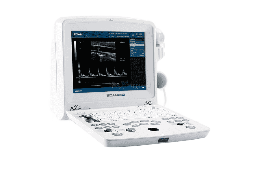 png clipart ultrasound ultrasonography ecografo medical imaging medical equipment doppler